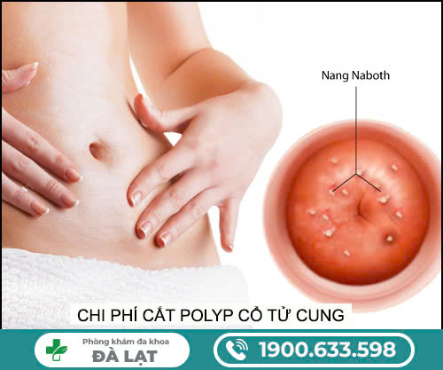 Hình ảnh minh họa